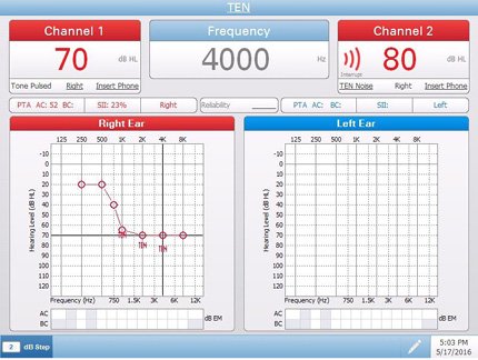 Pello Special Tests Audiometry Screen