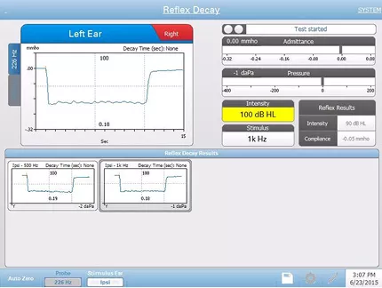 acoustic-reflex-testing-screen