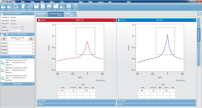 Tympanometry Results