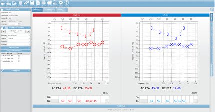 GSI Suite Pure Tone 