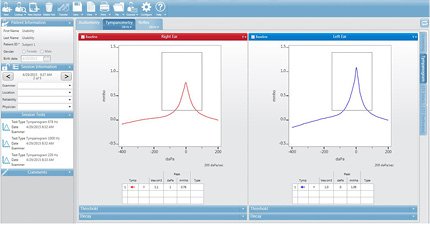 GSI Suite Tympanometry Data 