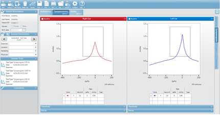 GSI Suite تیمپانومتری Data 